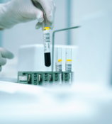 a-gloved-hand-holding-a-test-tube-filled-with-liquid.jpg a gloved hand holding a test tube filled with liquid